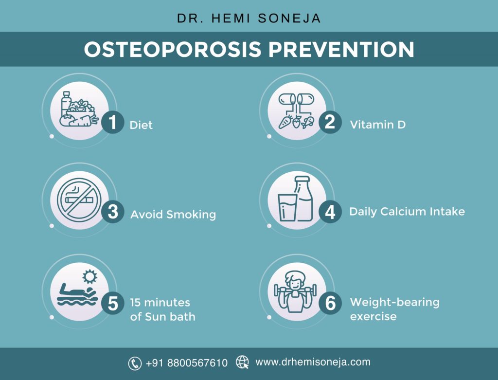 Osteoporosis prevention infographic: diet, vitamin D, no smoking, daily calcium, sunlight and weight-bearing exercise