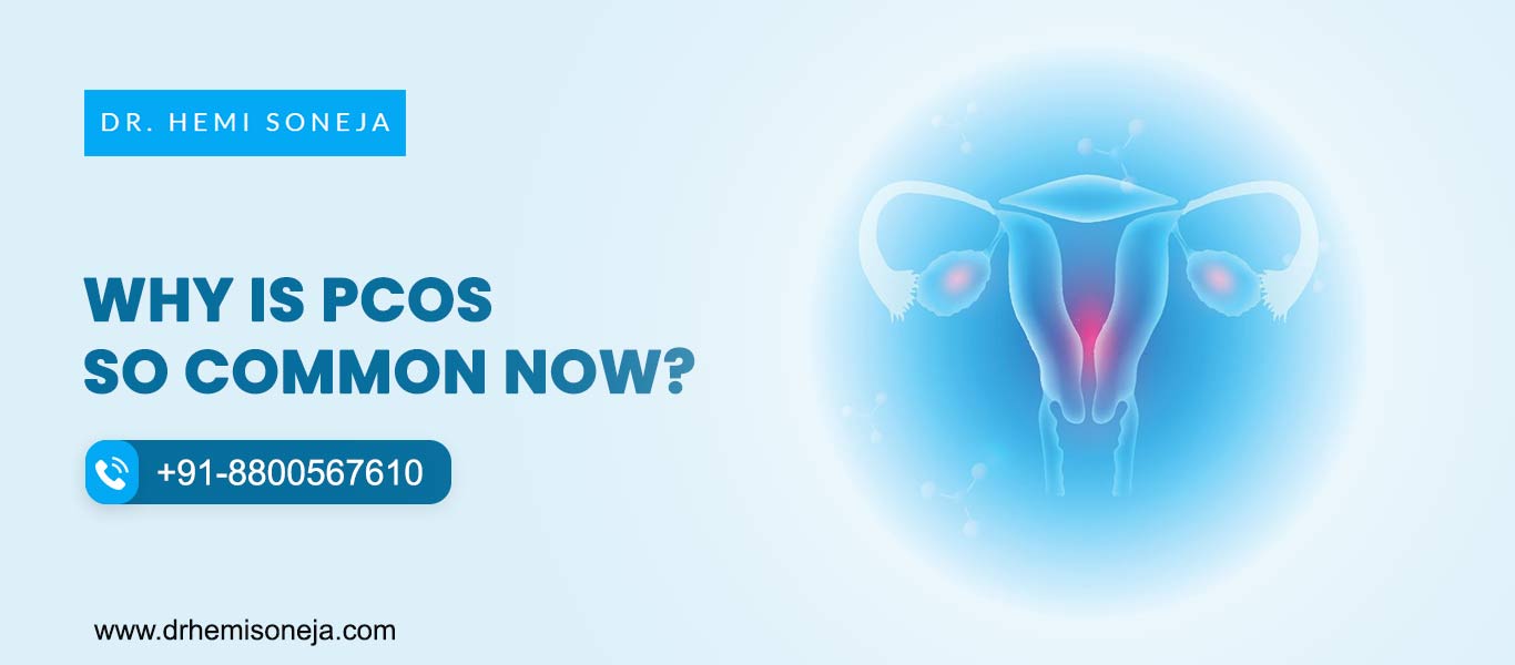 Prevalence of PCOS in India