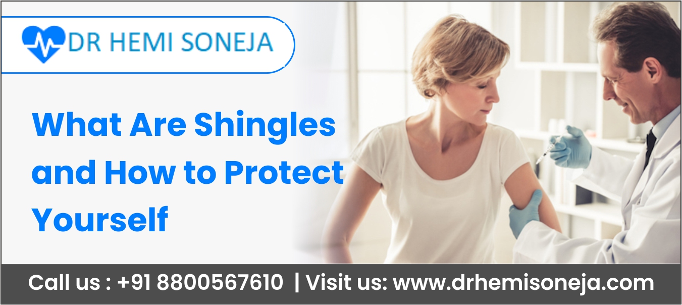 What are Shingles
